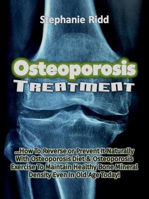 cover image of Osteoporosis Treatment